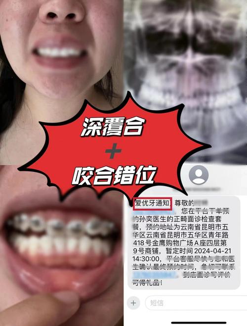 22岁牙齿矫正还来得及吗？年龄会影响效果吗？-图2