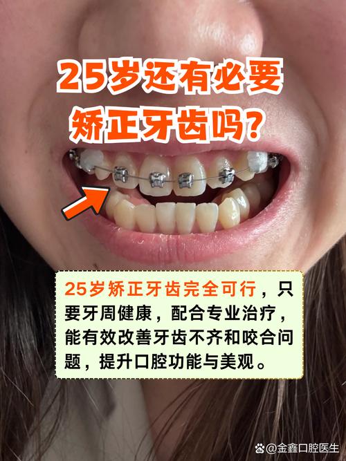 25岁矫正牙齿还来得及吗？-图1