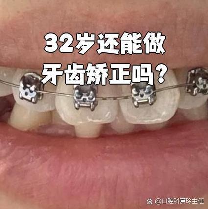 32岁还能矫正牙齿么-图3