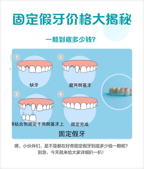 成人隐形矫正牙齿价格-图2