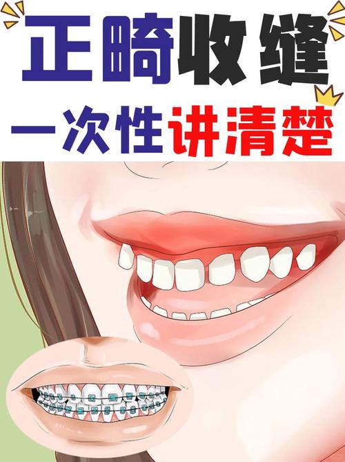 矫正牙齿后，如何有效防止反弹，保持效果？-图2