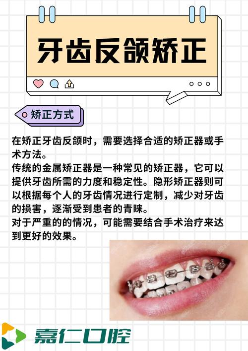 矫正牙齿后，如何有效防止反弹，保持效果？-图3