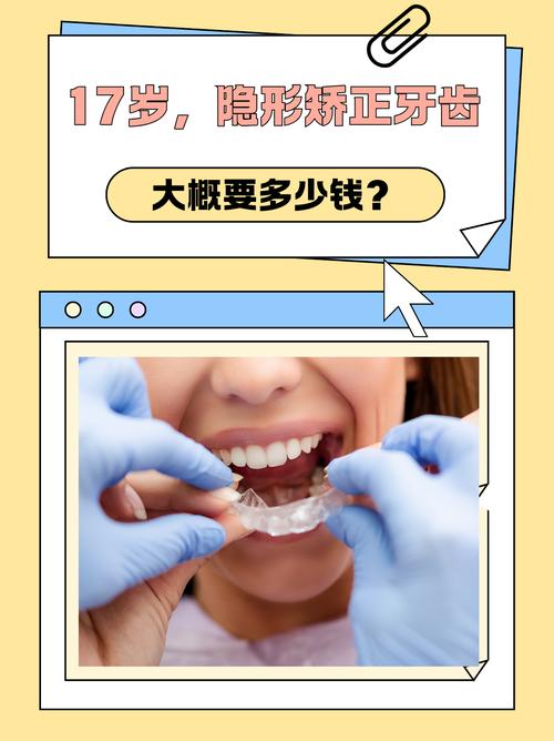 17岁矫正牙齿一般需要多长时间?-图1 17岁矫正牙齿一般需要多长时间?-图1