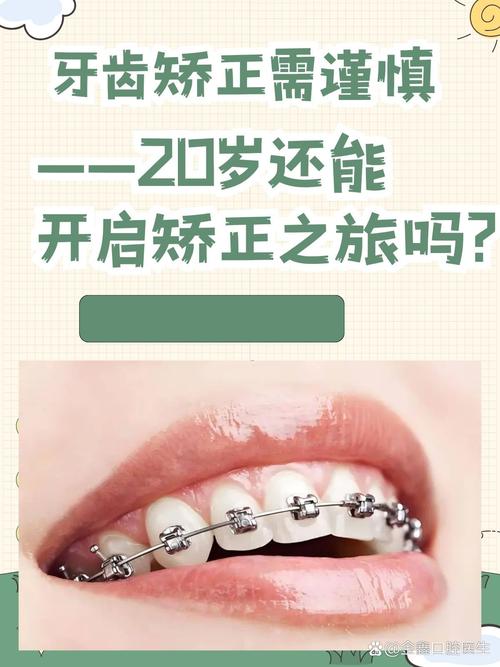20岁能不能矫正牙齿-图1