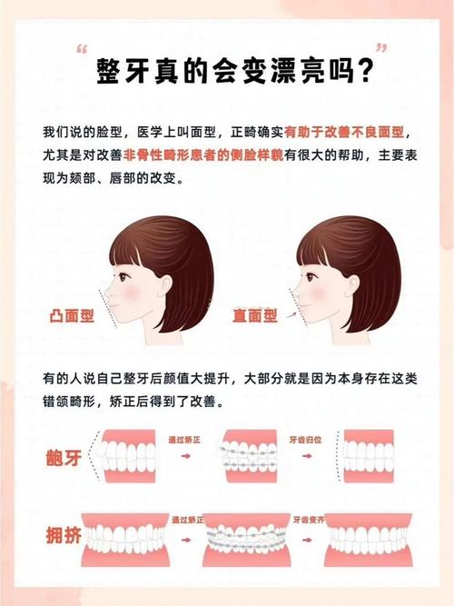 牙齿矫正会改变脸型么-图2