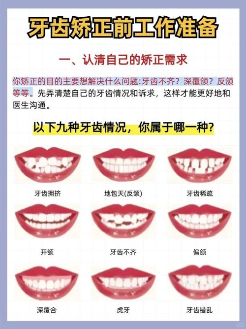 矫正牙齿哪里做最好?公立医院还是私立诊所更靠谱?-图2 矫正牙齿哪里做最好?公立医院还是私立诊所更靠谱?-图2
