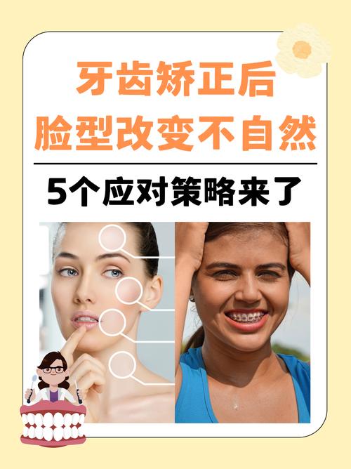 牙齿矫正后脸型会变吗？矫正真的能改变脸型吗？-图3