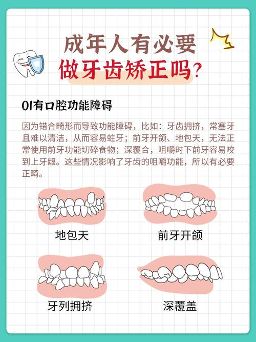 成年人牙齿还能矫正吗?-图1 成年人牙齿还能矫正吗?-图1