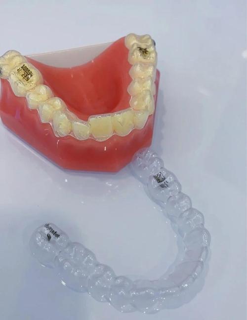 隐形牙齿矫正器有用吗?效果到底行不行?-图2 隐形牙齿矫正器有用吗?效果到底行不行?-图2