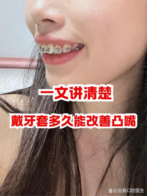 不戴牙套怎么矫正牙齿-图2 不戴牙套怎么矫正牙齿-图2