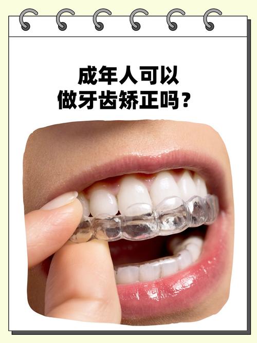成年人矫正牙齿，真的可以吗？会有哪些影响和注意事项？-图1