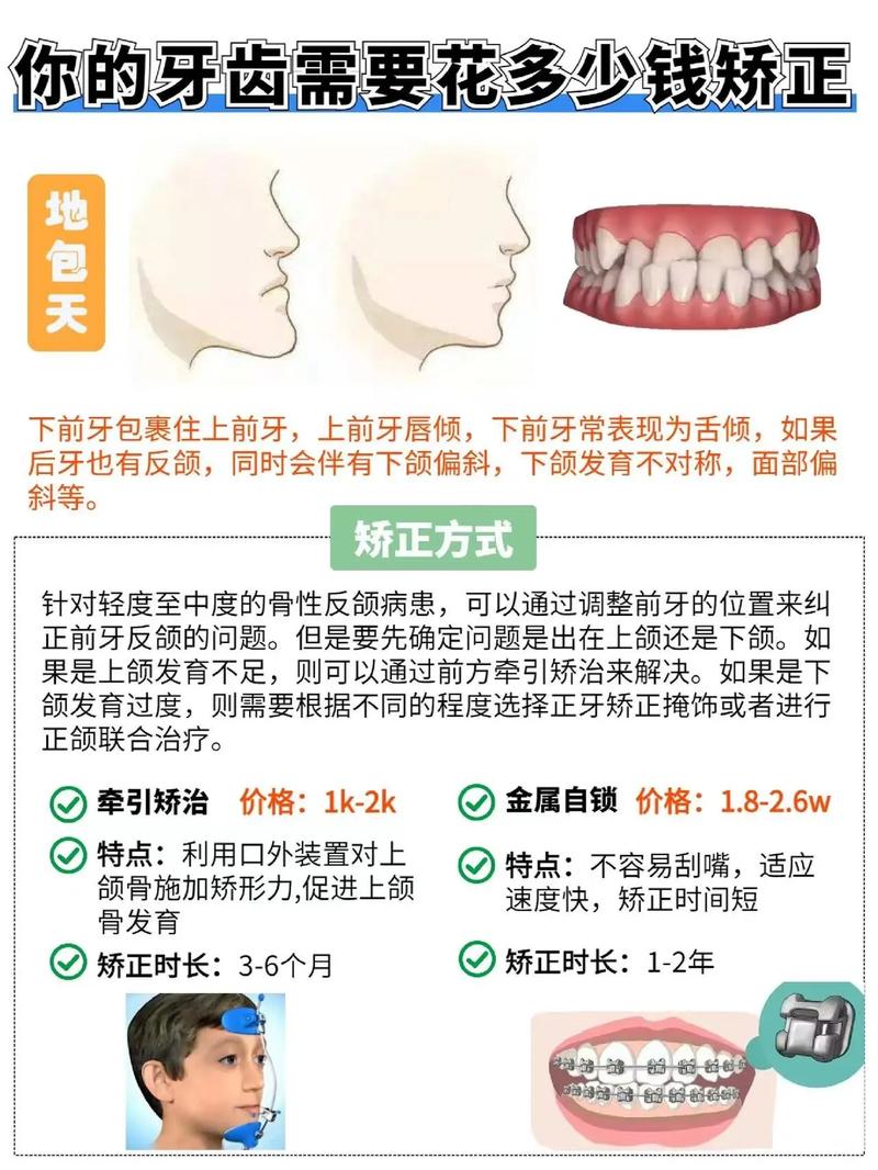 青少年矫正牙齿要花多少钱?价格差异大吗?-图3 青少年矫正牙齿要花多少钱?价格差异大吗?-图3