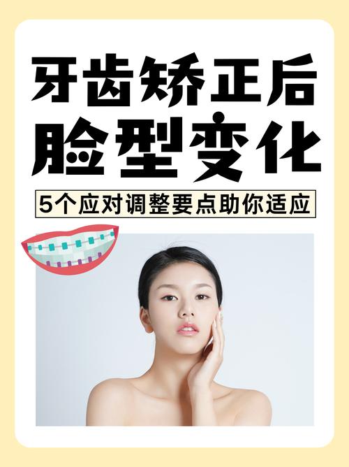 矫正牙齿到底能不能改变脸型？-图2