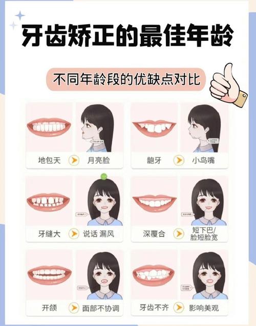 儿童牙齿矫正的最佳年龄是什么时候？越早越好吗？-图3