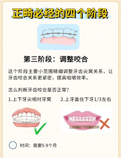 MBT牙齿矫正的标准流程是怎样的？包含哪些关键步骤？-图1