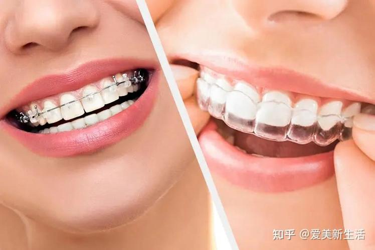 哈尔滨矫正牙齿哪家医院效果最好?-图2 哈尔滨矫正牙齿哪家医院效果最好?-图2