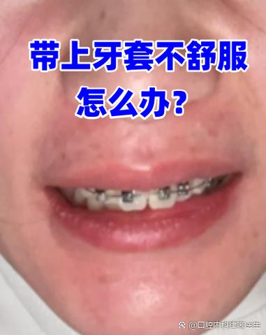 矫正牙齿移动痛，正常吗？如何缓解？-图1