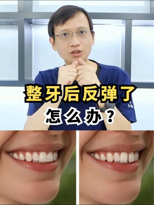 牙齿矫正失败后为何要停止？这些关键原因需警惕！-图1