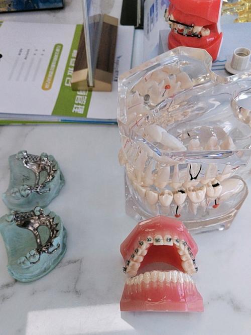 摩尔齿科牙齿矫正效果如何？价格和时间靠谱吗？-图3