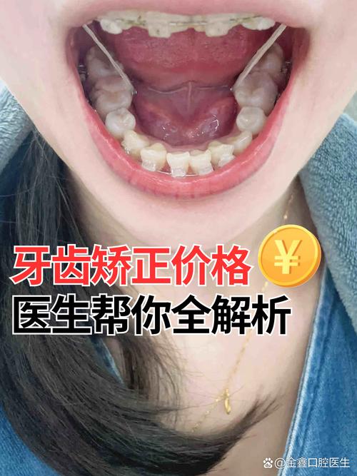 牙齿矫正 但是出国-图2 牙齿矫正 但是出国-图2