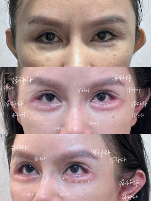 新加坡眼视角，牙齿矫正有哪些独特优势值得关注？-图3