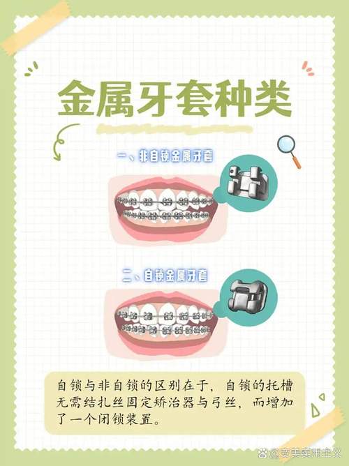 牙齿矫正器矫正牙齿的原理究竟是如何实现的?-图3 牙齿矫正器矫正牙齿的原理究竟是如何实现的?-图3