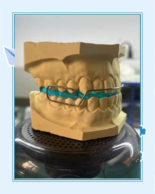 牙齿功能矫正器与传统矫正器功能差异在哪?-图3 牙齿功能矫正器与传统矫正器功能差异在哪?-图3