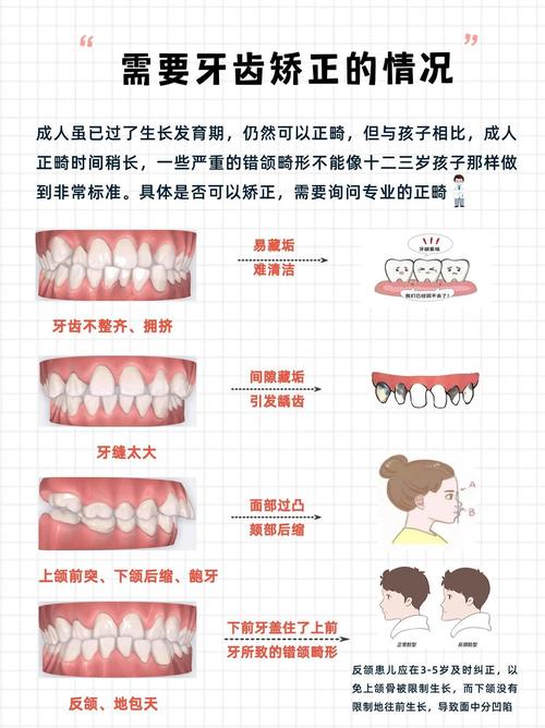 矫正牙齿是矫正哪里-图1