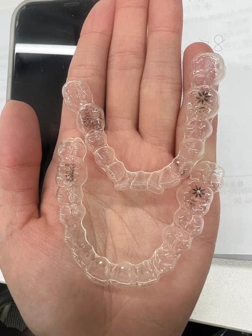 牙齿矫正器怎么选？哪种类型更适合自己？-图2