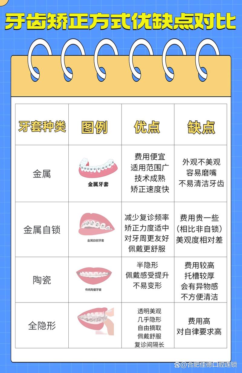 牙齿矫正一次性付清费用划算吗？-图3