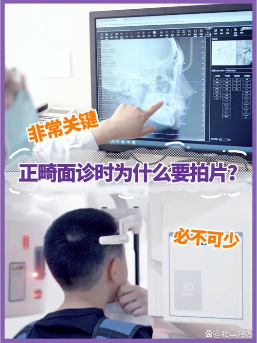 牙齿矫正需要拍片吗-图2