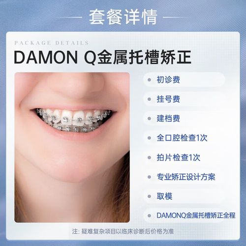 拜博矫正牙齿怎么样?效果、体验和口碑真实情况如何?-图1 拜博矫正牙齿怎么样?效果、体验和口碑真实情况如何?-图1