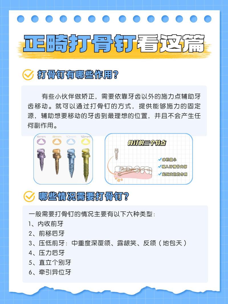 矫正打骨钉疼不疼?牙齿矫正骨钉植入痛感如何?-图2 矫正打骨钉疼不疼?牙齿矫正骨钉植入痛感如何?-图2