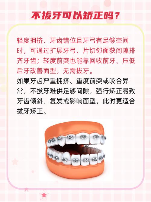 牙齿矫正用不用拔牙-图2