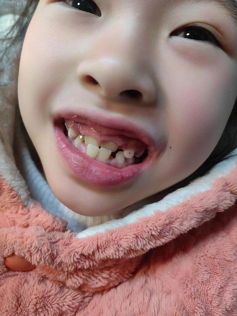 矫正后门牙松动？原因与应对方法是什么？-图3