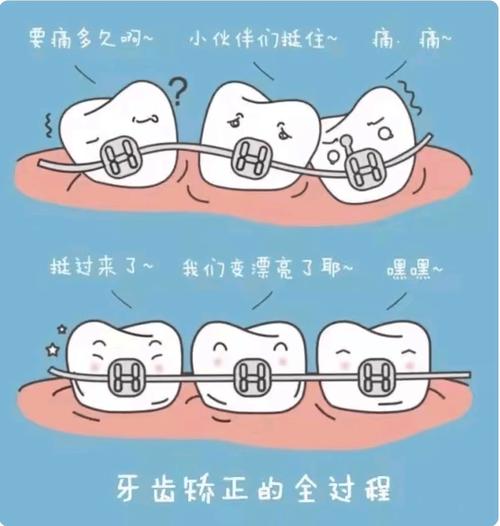 矫正牙齿全过程图片都包含哪些关键步骤？-图1