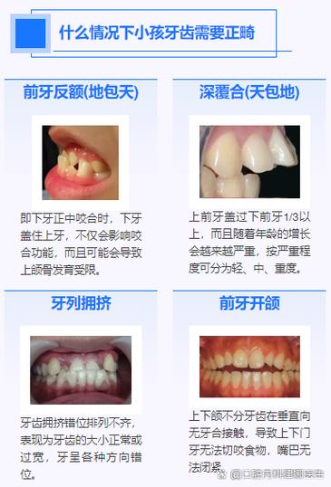 有乳牙能矫正牙齿吗-图1