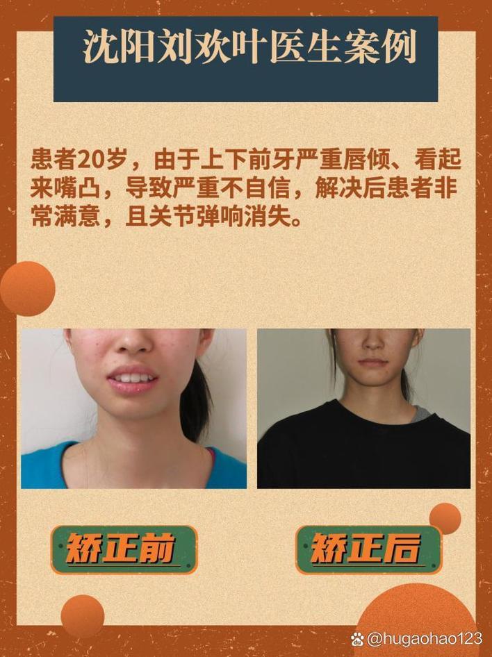 沈阳牙齿矫正去哪好-图2 沈阳牙齿矫正去哪好-图2