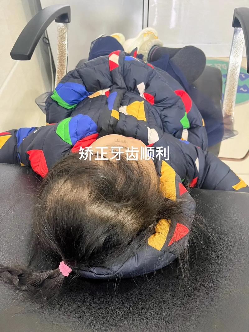 沈阳牙齿矫正去哪好-图3 沈阳牙齿矫正去哪好-图3