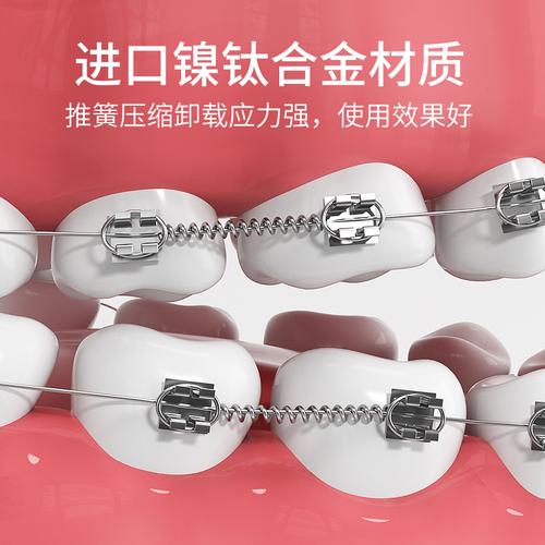 为什么矫正牙齿要戴小弹簧?它到底有什么作用?-图1 为什么矫正牙齿要戴小弹簧?它到底有什么作用?-图1