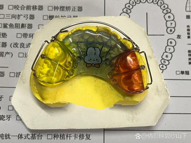 为什么矫正牙齿要戴小弹簧?它到底有什么作用?-图3 为什么矫正牙齿要戴小弹簧?它到底有什么作用?-图3