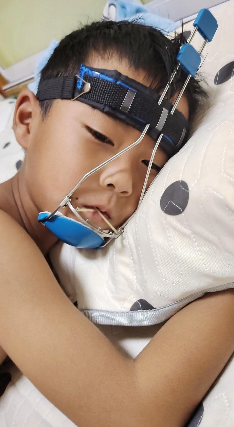 做牙齿矫正很痛苦吗-图2