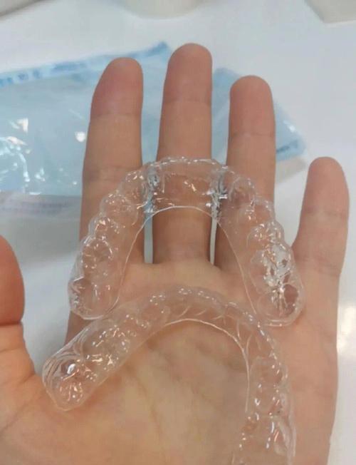 矫正完牙齿戴保持器-图3 矫正完牙齿戴保持器-图3