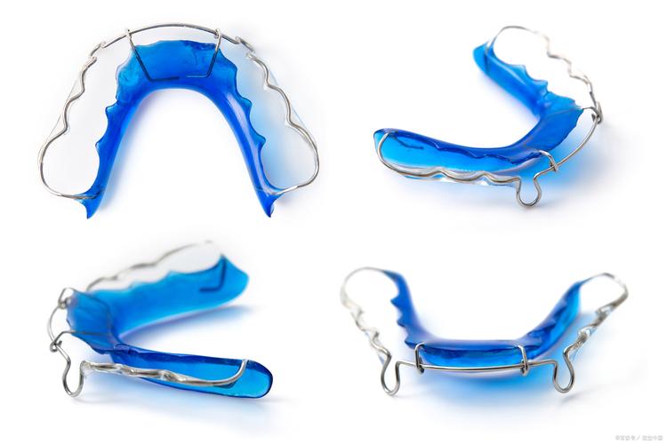 牙齿矫正器哪种最好？效果、舒适度、价格如何权衡？-图3