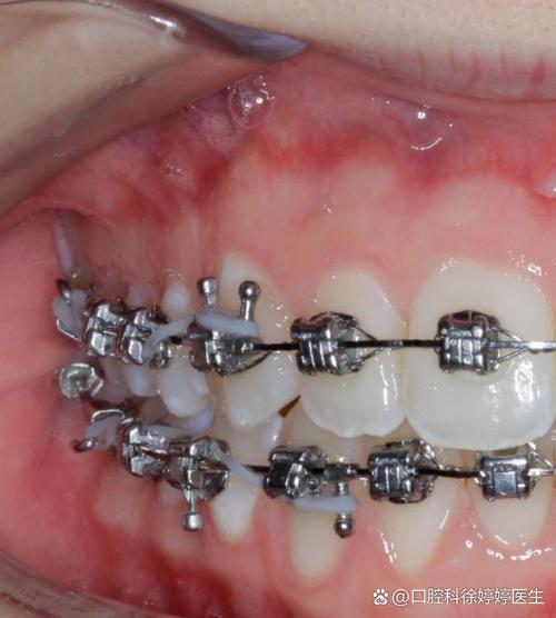 矫正牙齿什么地方好-图3