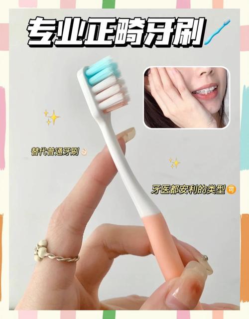 陶瓷自锁矫正牙齿图-图1