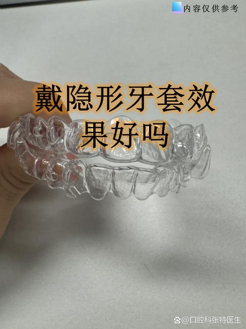 隐形矫正牙齿有用吗-图1