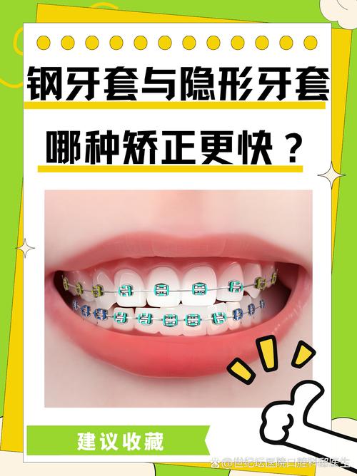 牙齿矫正戴牙套好吗？效果与利弊如何权衡？-图3