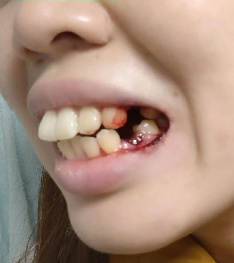 牙齿矫正没什么感觉？这是正常现象吗？-图3