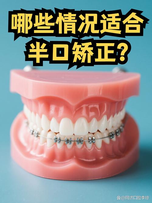 矫正牙齿哪家口腔机构更专业？-图1